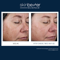 Load image into Gallery viewer, Alto Advanced Defense and Repair Serum