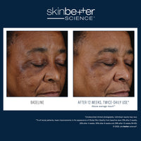 Load image into Gallery viewer, Mystro Active Balance Serum