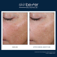 Load image into Gallery viewer, AlphaRet Overnight Cream