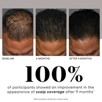 Load image into Gallery viewer, Hair Serum