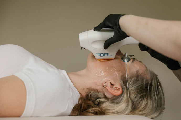 The Winter Routine Your Skin Needs