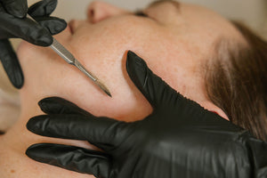 Dermaplaning