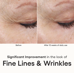 Intense Serum